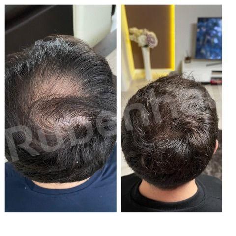 Vertex restoration — Before / After