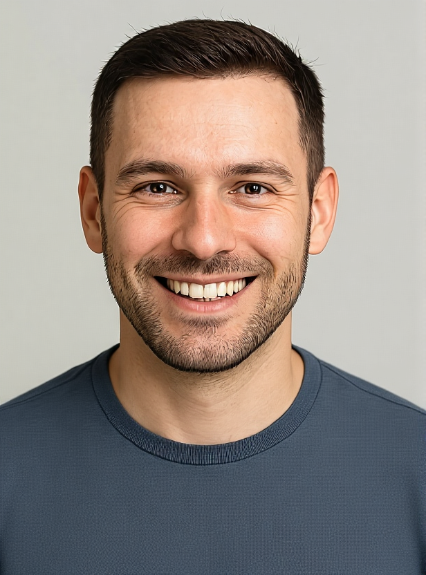 After - Hair Transplant